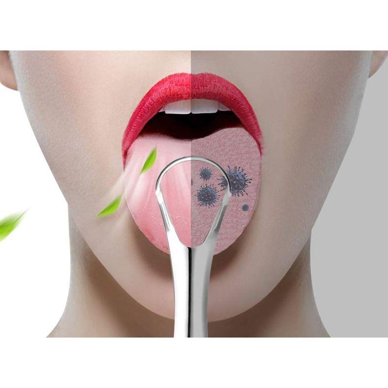 Trikeel - Grattoir à langue en acier inoxydable