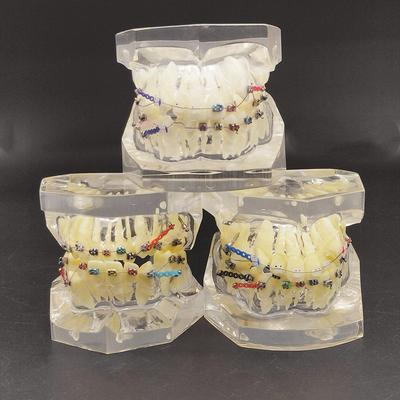 1 kus Transparentní dentální ortodontický mallocclusion model s držáky Archwire bukální trubice pro komunikaci s pacientem