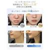 Facial device EMS vacuum negative pressure suction outer inner lift care 7 color light esthetic beautiful face line small 3 level adjustment clear Day