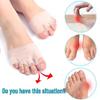 Five-Hole Honeycomb Forefoot Pad with Breathable Silicone for Pain Relief, Toe Correction, Bunion Separation, and Orthotic Support.
