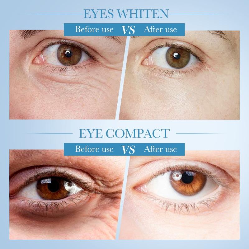 Ser de ochi Esență de rulare antirid Colagen Hidratant Albire Reparare Soluție de îngrijire a ochilor pentru îndepărtarea pungilor