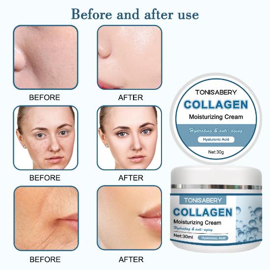 

Крем с коллагеном, отбеливающий, увлажняющий, против морщин, против старения, удаляет темные пятна, корейский уход