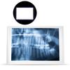 AC110- Przeglądarka zdjęć dentystycznych Podświetlarka LED z uchwytem Klips do mocowania zdjęć
