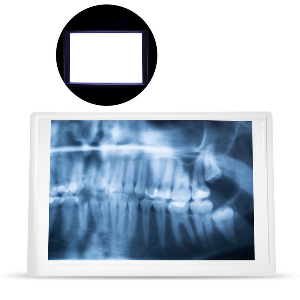 AC110- Przeglądarka zdjęć dentystycznych Podświetlarka LED z uchwytem Klips do mocowania zdjęć