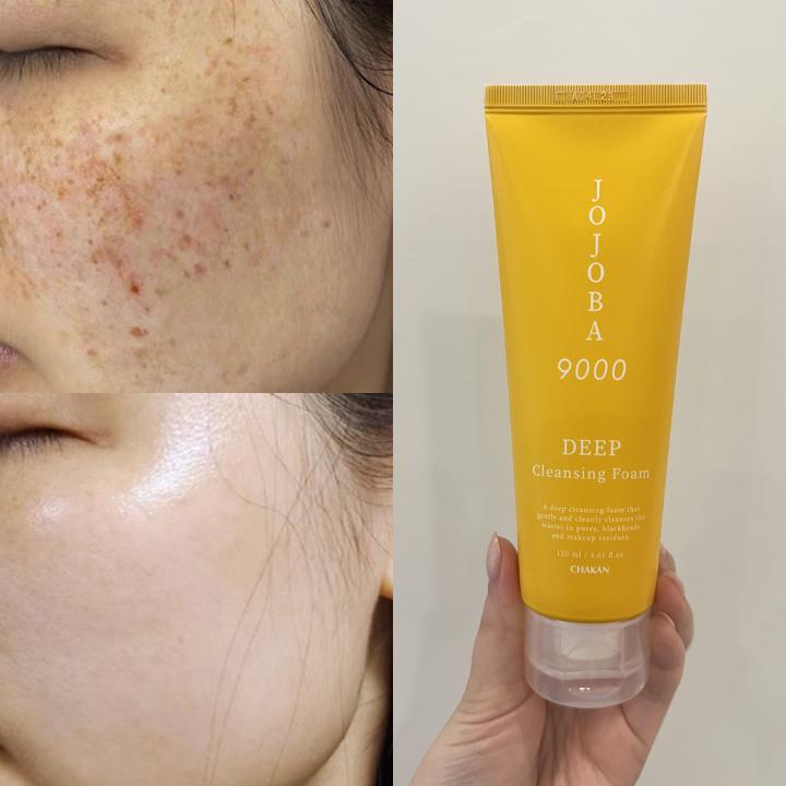 Hojoba9000 Deep Cleansing Foam: