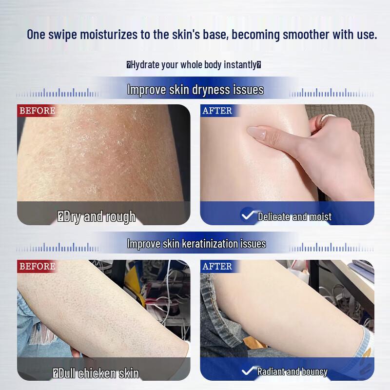 UNIO 20% Urea Body Cream