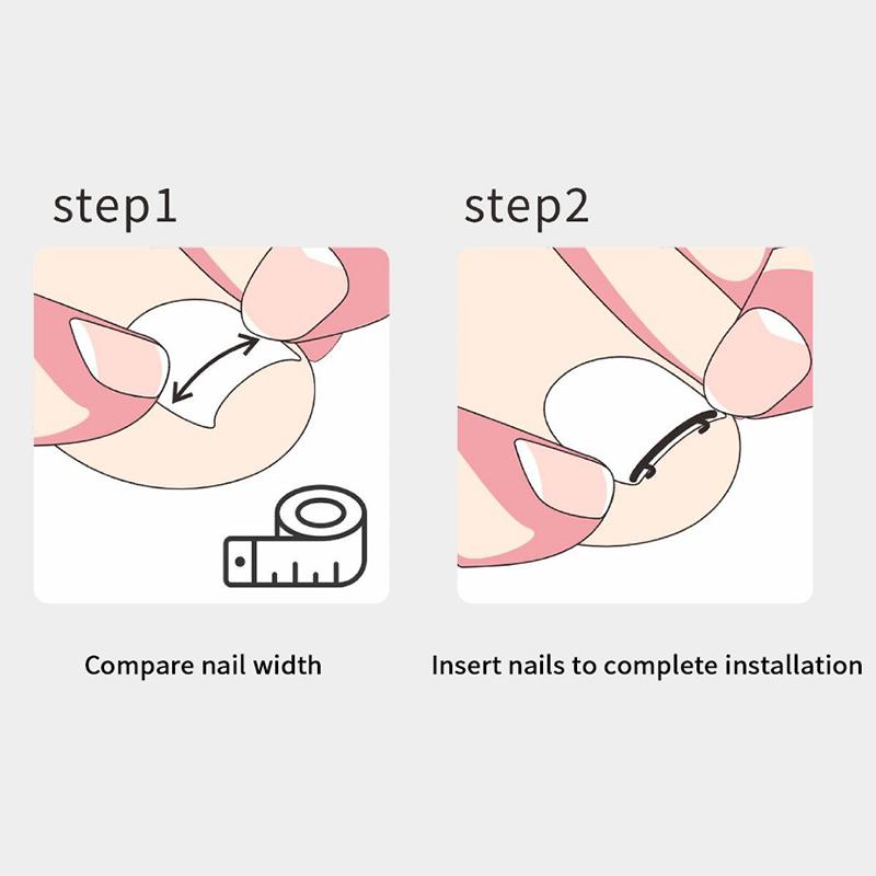 Toe Ingrown Pedicure Nail Buckle Toenails Corrector Foot Nail Correction Tool Straightening Clip Curved Brace Corrector