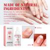 Eelhoe Peach Nail Care Oil 30ml For Stronger Healthier Nails Repair Restore Shine