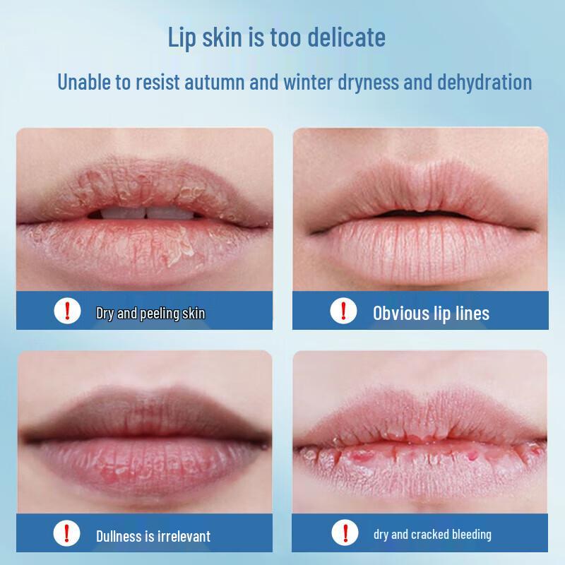 MKING PRETTY Lip Collection