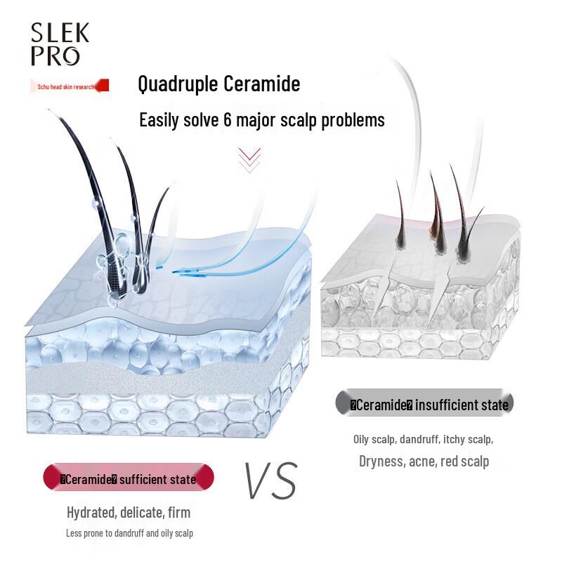 ShuLei Anti-Dandruff Oil Control Shampoo