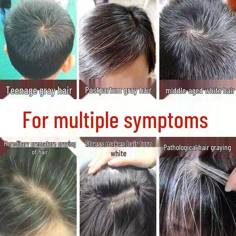 Herbal Hair Growth & Thickening Lotion: Anti-Hair Loss, Follicle Repair, Accelerated Hairline & Hair Density Enhancement.