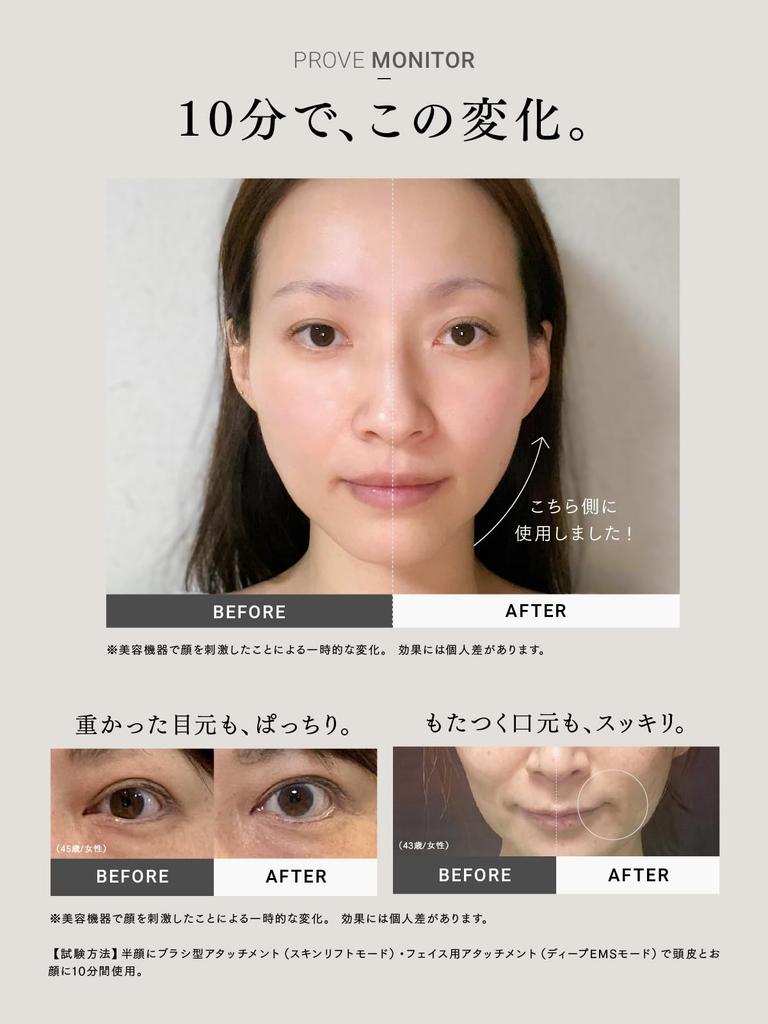 Best Overall MYTREX PROVE Facial Beauty Device with Electric Popular Total Lift EMS Eye Gift Prove Eye Attachment Attachment [My Winner!] Brush,