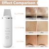 Ultrasonic Skin Scrubber Scrubber Deep Vibrate Facial Cleaner Shovel Face Scrubber Peeling Black Head Remover Facial Massager