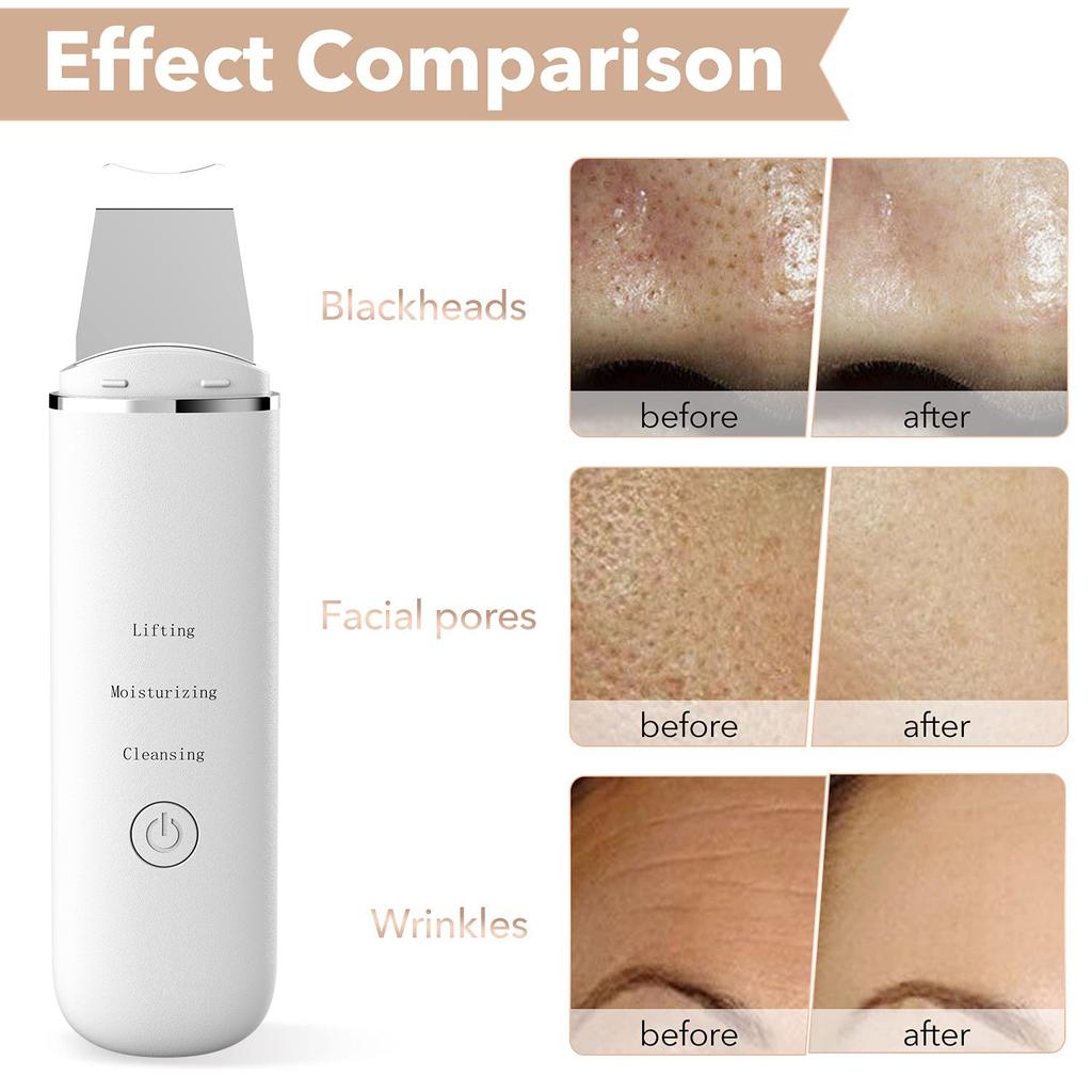 Ultrasonic Skin Scrubber Scrubber Deep Vibrate Facial Cleaner Shovel Face Scrubber Peeling Black Head Remover Facial Massager