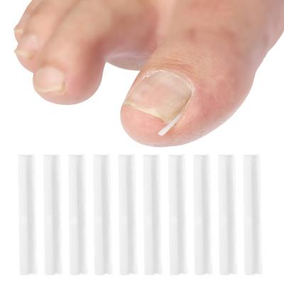 10/20/30/50 Stück Nagelpad, einfach zu verwendendes, multifunktionales, leichtes Füllpad für eingewachsene Nägel für zu Hause