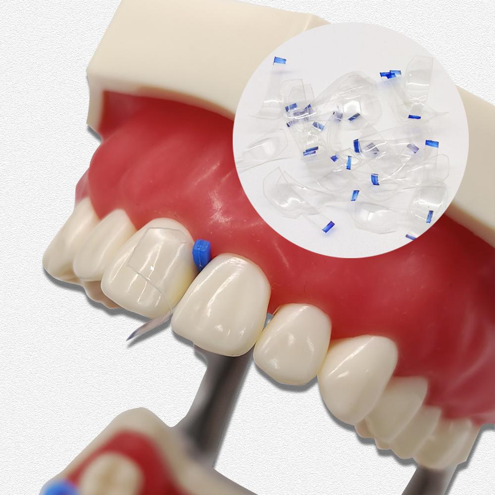 Dental Transparent Sectional Contoured Matrices Matrix Polyester Matrice  for Anterior and Posterior Teeth