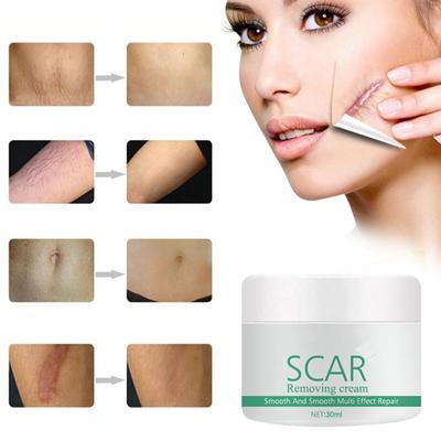 Silicone Scar Gel Scar Cream Recovery Cream Desalinate Burn Scar Skin Smoothing Cream 30ml