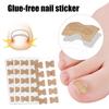 20Pcs Ingrown Toenails Correction Patches Breathable Painless Ingrown Toenail Treatment Tool Professional Ingrown Toenail Straightener Corrector