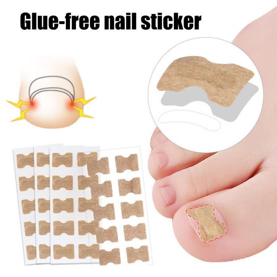 20Pcs Ingrown Toenails Correction Patches Breathable Painless Ingrown Toenail Treatment Tool Professional Ingrown Toenail Straightener Strips