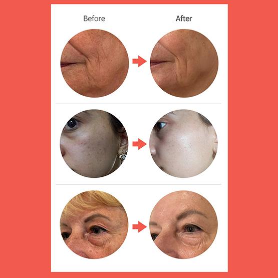 DERMALINE PDRN-Lösung Lachsampulle 35ml