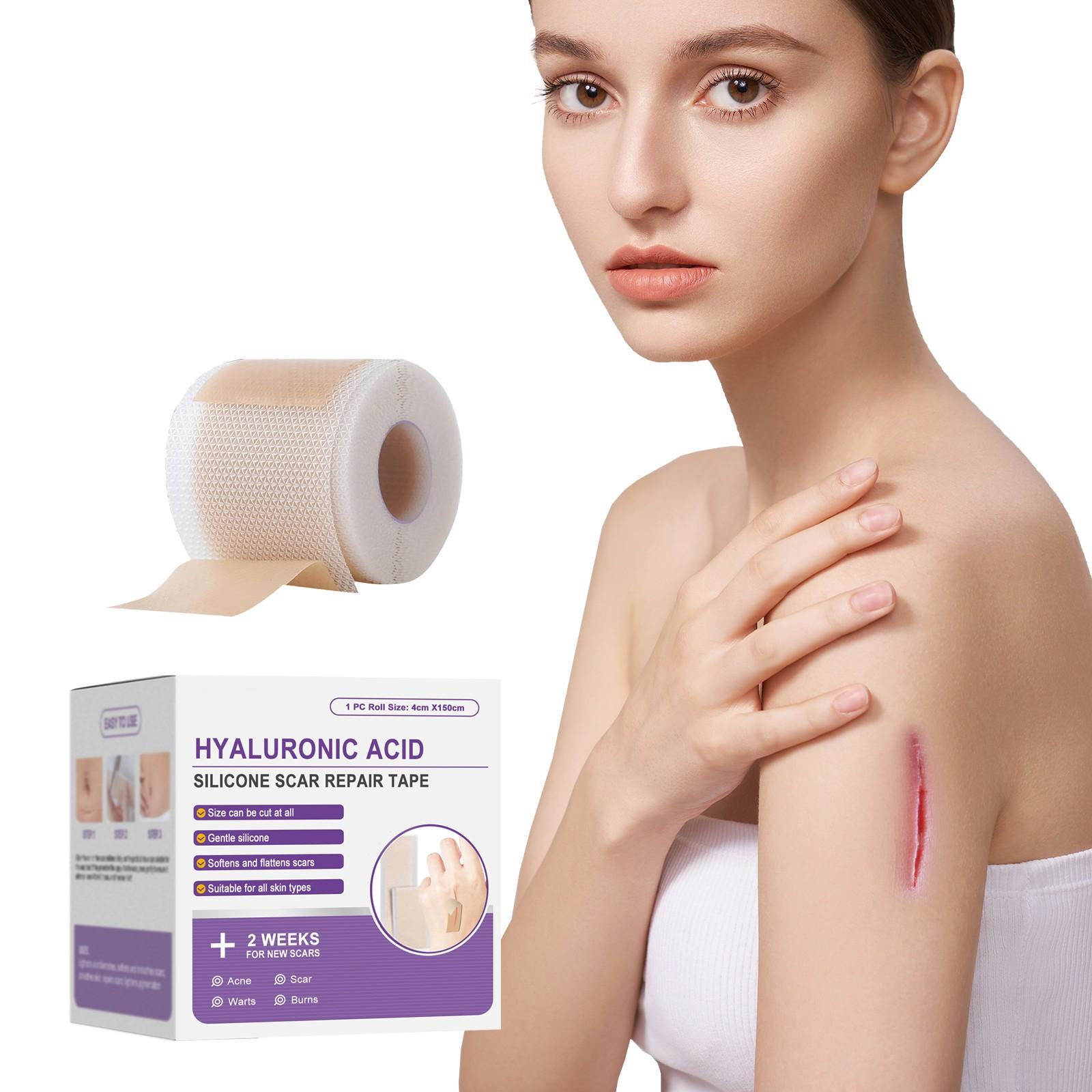 

Силиконовый пластырь от рубцов Пластырь для ежедневного ухода за кожей, помогающий улучшить состояние рубцов One Size белый