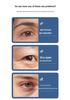 EMS Microcurrent Eye Massager for Dark Circles with Heat Therapy