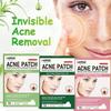 72Pcs Invisible Acne Patchesanti-Acne Hydrocolloid Patches Spots Marks Concealer Repair Sticker Waterproof