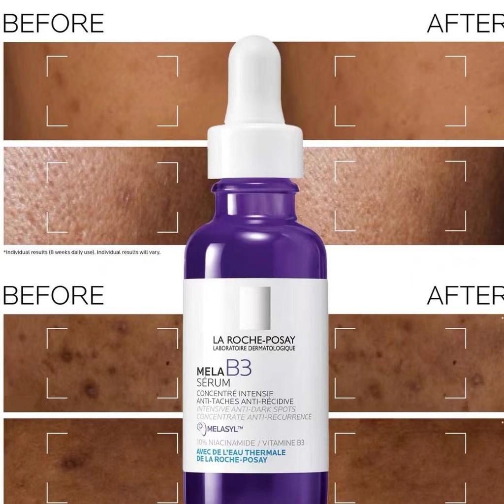 Siero Viola Rivitalizzante B3 con Niacinamide al 10% per Illuminare e Idratare la Pelle 30ml