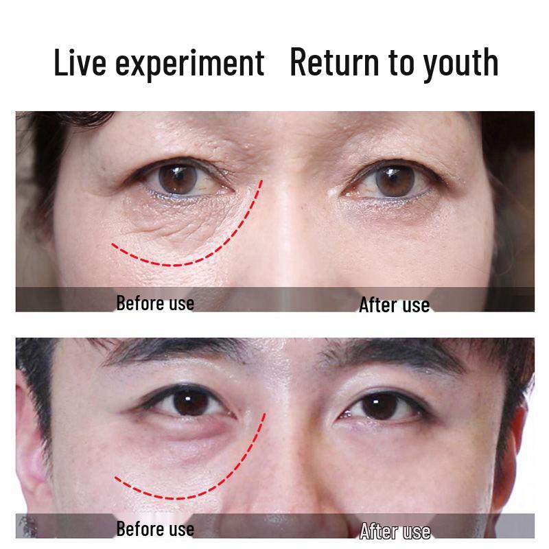 Eye Cream: Reduces Fine Lines, Firms, Hydrates, Minimizes Dark Circles & Eye Bags, Lifts, and Moisturizes for Anti-Wrinkle Eye Care.