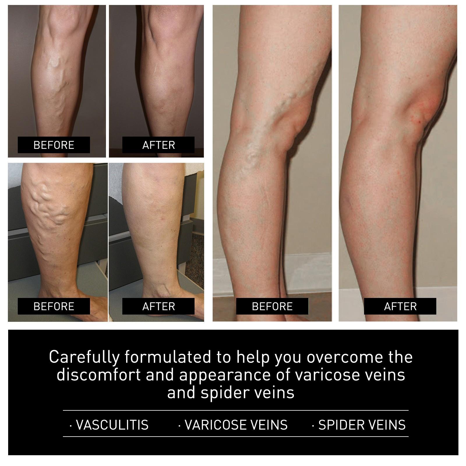 Дышащая подушечка из ледяного шелка снимает болезненность и отек суставов — фото 6