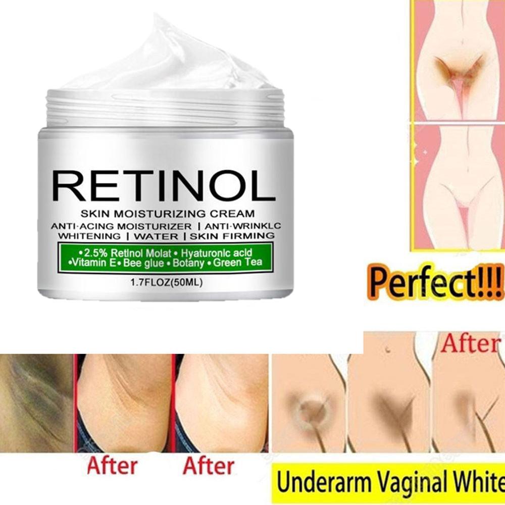 Private Remove Pigmentation Body Whitening Cream Underarm Knee Buttocks Melanin Improve Body Dull Moisturizer Brighten Skin Care