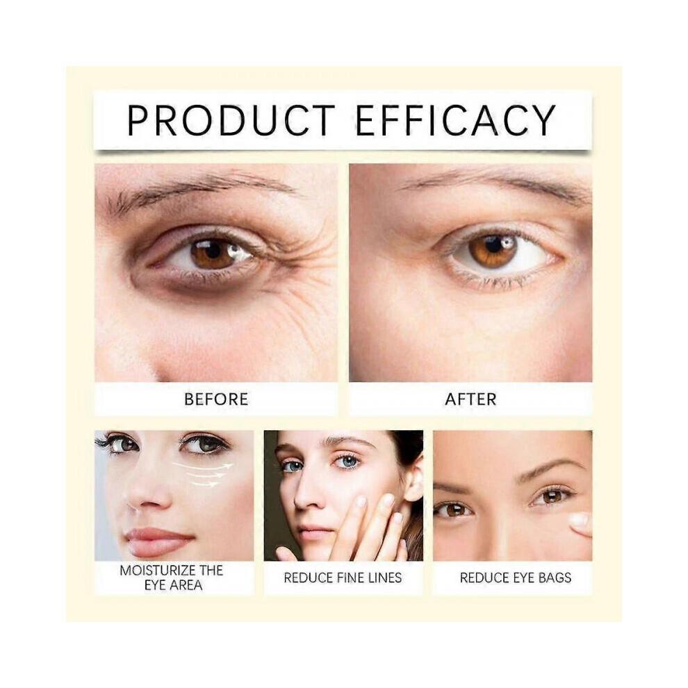 My Perfect Eyes Anti-ageing Eye Serum Lines Reduces Wrinkles for Dark Circles