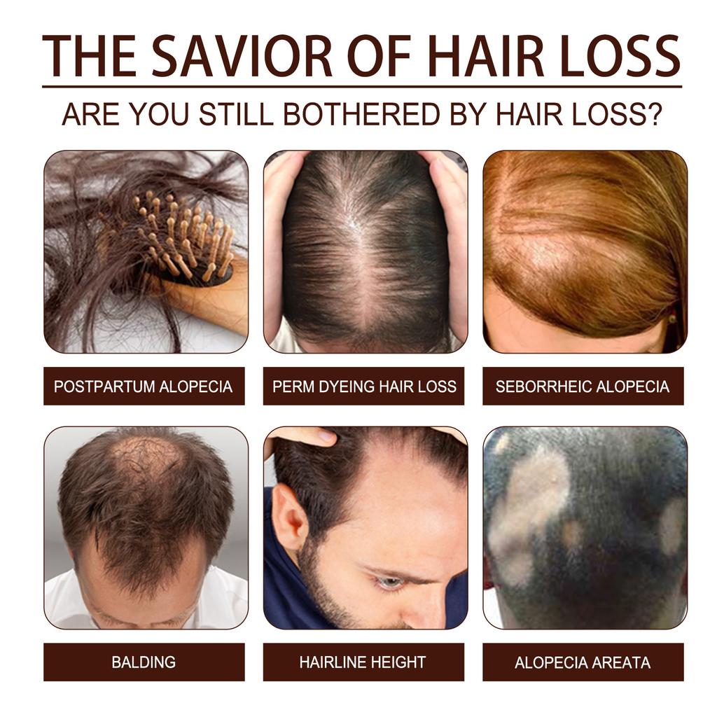 Eelhoe Fermentowane serum z wodą ryżową Naturalna delikatna woda ryżowa Fermentowana woda ryżowa Esencja do włosów Serum na porost włosów na przerzedzenie włosów 60ml