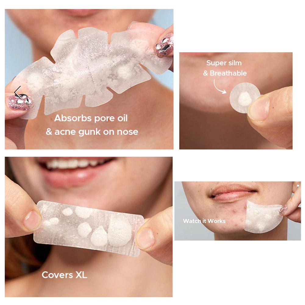 Large capacity Pimple Patches for Acne & Blemishes Various Shapes Covering Acne and Spot Patches for Face Skin Care Tool