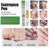 Exstroyeza Nail Repair Pen - Fungal Treatment & Nourishing Solution for Healthy, Clear Nails On Hands & Feet - 5ml Portable Nail Care for Bacterial In