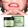 JoyPretty Kräuter Akneentferner Gesichtscreme Gegen Pickelentferner Aknebehandlung Anti Akne Feuchtigkeitsspendend Reparierend Geschädigte Hautpflege