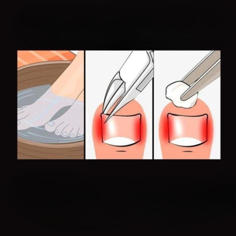 Professional Toe Nail Clipper Cutter Nail Correction Nippers Heavy Duty Thick Nails Tool Cut Nail Stainless Steel Toe Trimmer