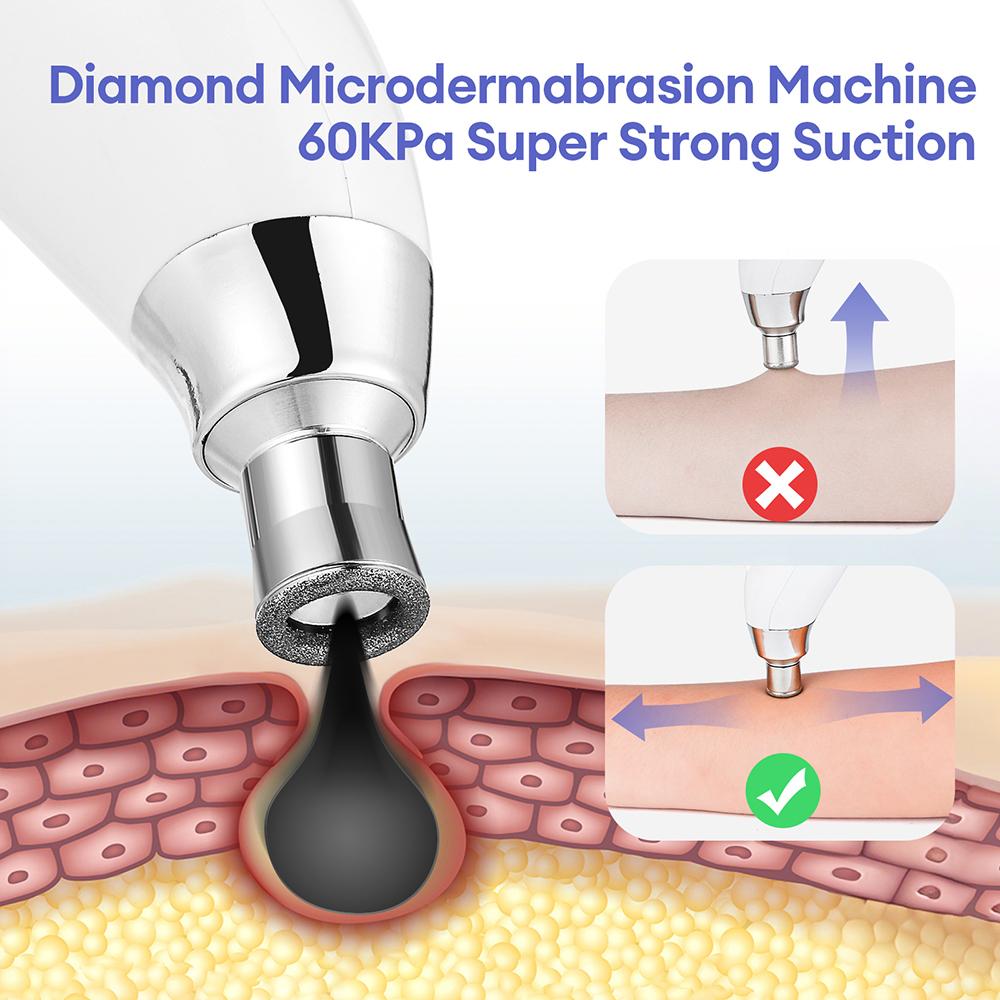 7 Gear Suction Diamond Microdermabrasion Machine -60KPa Handhold Diamond Facial Device Remove Blackhead Skin Exfoliate Tool