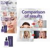 Eelhoe Tightening Facial Essence For Youthful Skin With Wrinkle Repair Hydration And Firmness 30ml