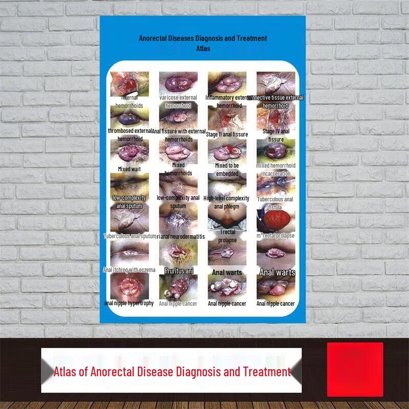 Human Anatomy and Disease Diagnostic Teaching Chart