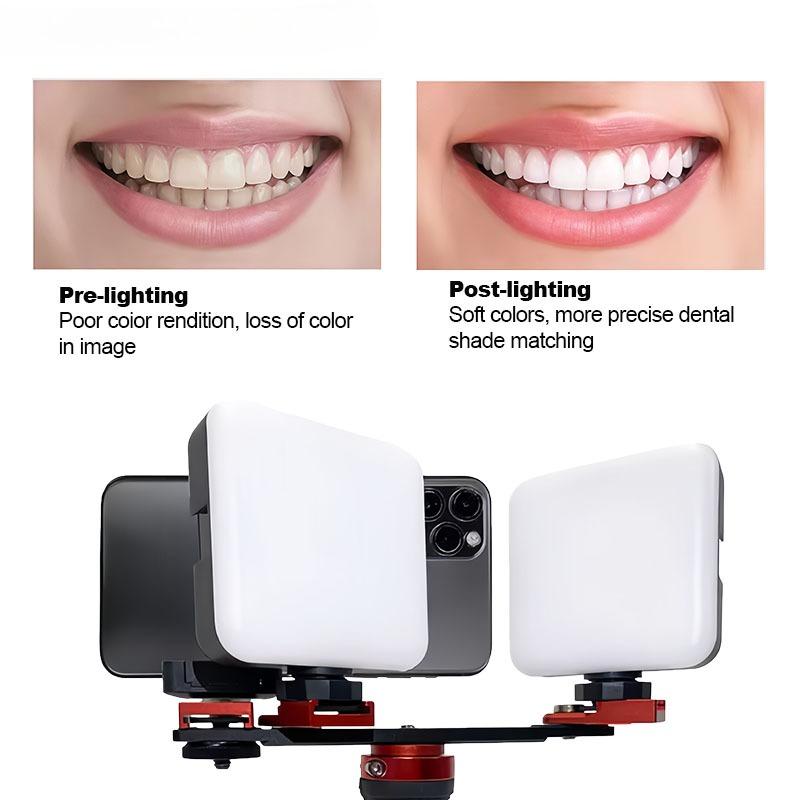 Dental Intraoral Photography Mobile Phone Fill Light Multifunctional Portable Handheld Color Matching Light Oral Accessories