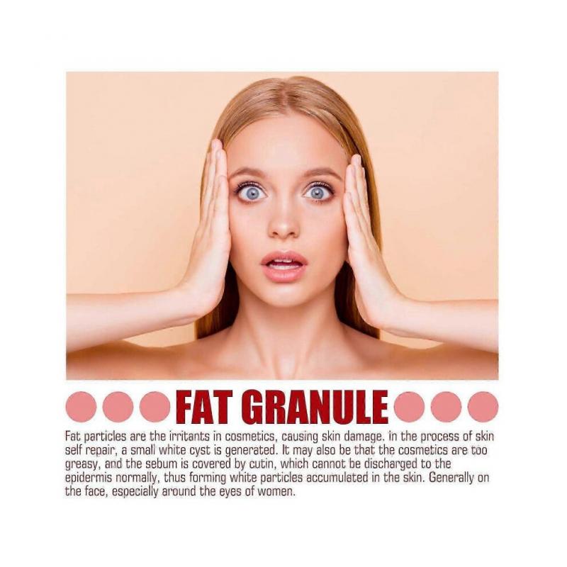 South Moon Facial Treatment Serum Eye Serum Eye Granules Repair Hydrating Serum