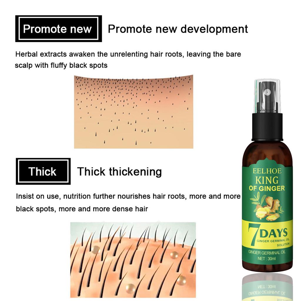 Huile capillaire au gingembre et sérum à la biotine, massage nourrissant du cuir chevelu au gingembre pendant 7 jours pour tous types de cheveux, soin hydratant, spray capillaire au gingembre