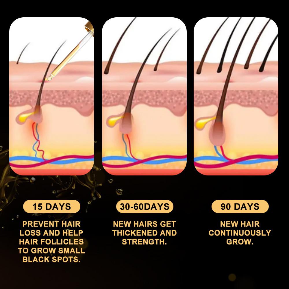 30ML Hair Growth Oil Nourishes The Scalp and Promotes Healthy Hair Growth and Nourishing Care Oil