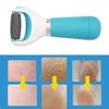 The Electric Foot Grinder Can Remove The Dead Skin The Feet Comfortably