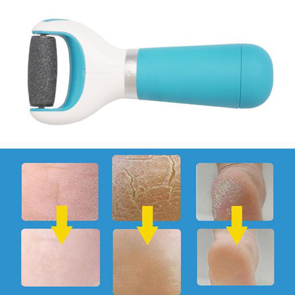 The Electric Foot Grinder Can Remove The Dead Skin The Feet Comfortably