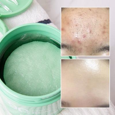 Trouble Pore beruhigendes Peeling Talg Centellacica 90 % echtes Tonerpad