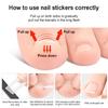 10 Pezzi Strisce Correttive per Unghie Incarnite per Sollevamento Delicato e Allineamento dell'Unghia Strumenti per Pedicure da Salone o per Uso Domestico per Adulti