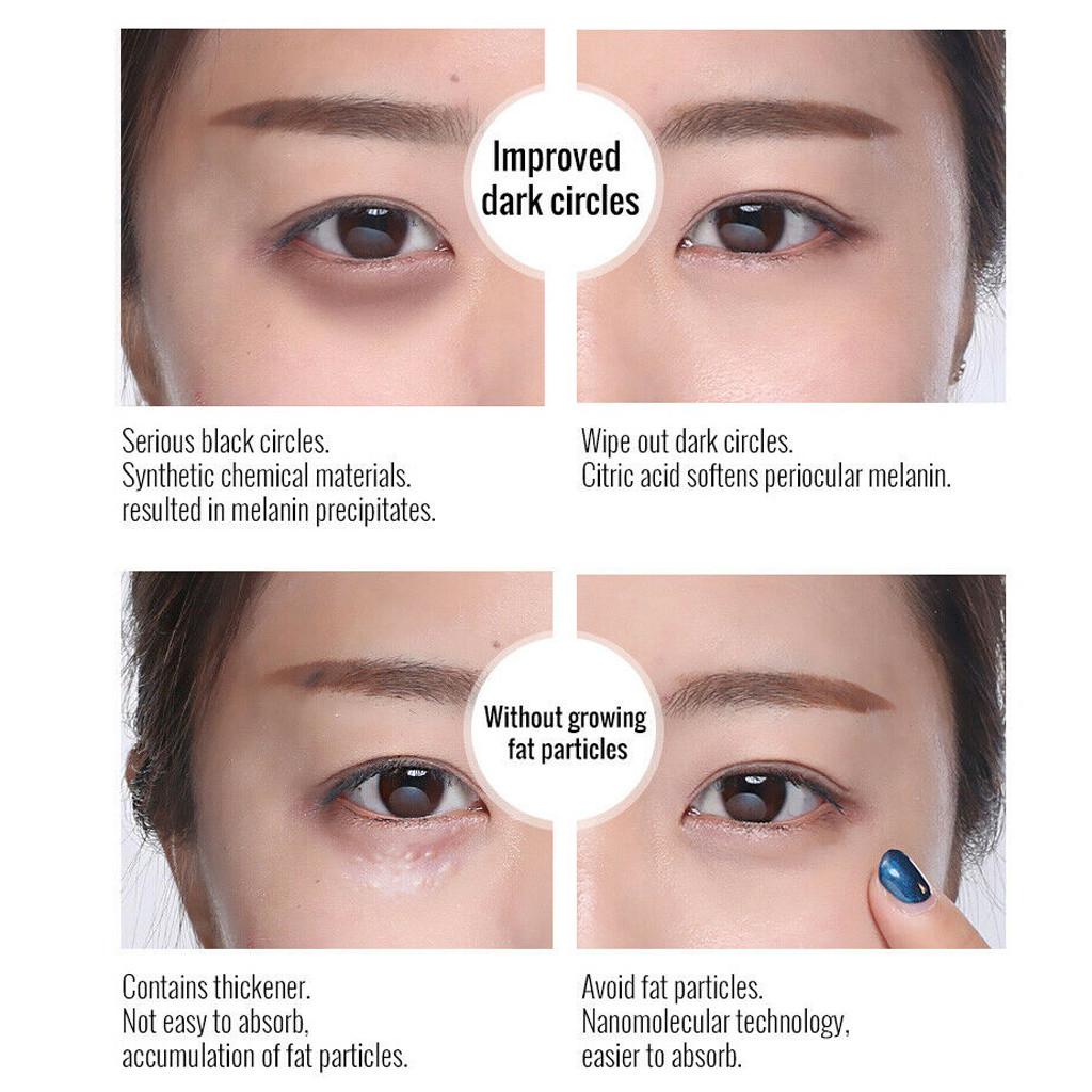 Buy 3pc OMY LADY AgeDefying Anti Wrinkle Eye Serum Cream Reduce Bag