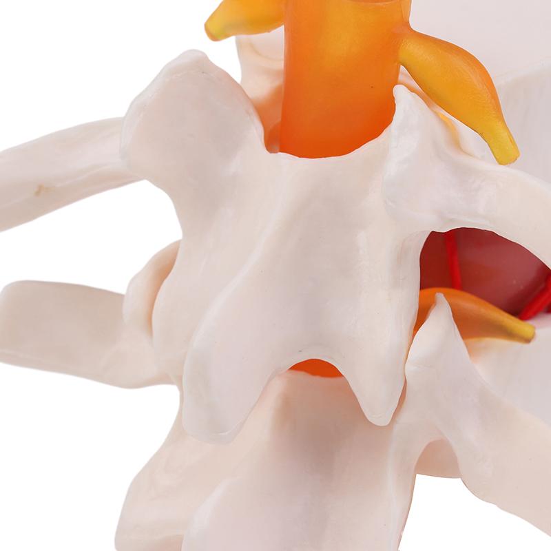 Menselijke Anatomie Skelet Wervelkolom Hernia Lumbalis Onderwijsmodel Hersenen Schedel Traumatisch Schoolbenodigdheden Medisch Instrument